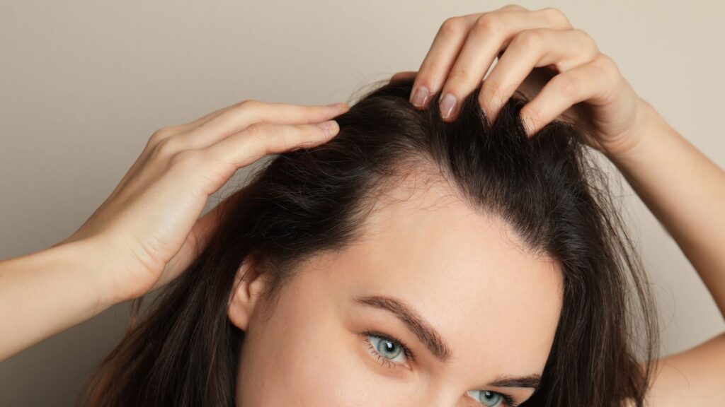 Szülés utáni hajhullás: Okok és megoldások